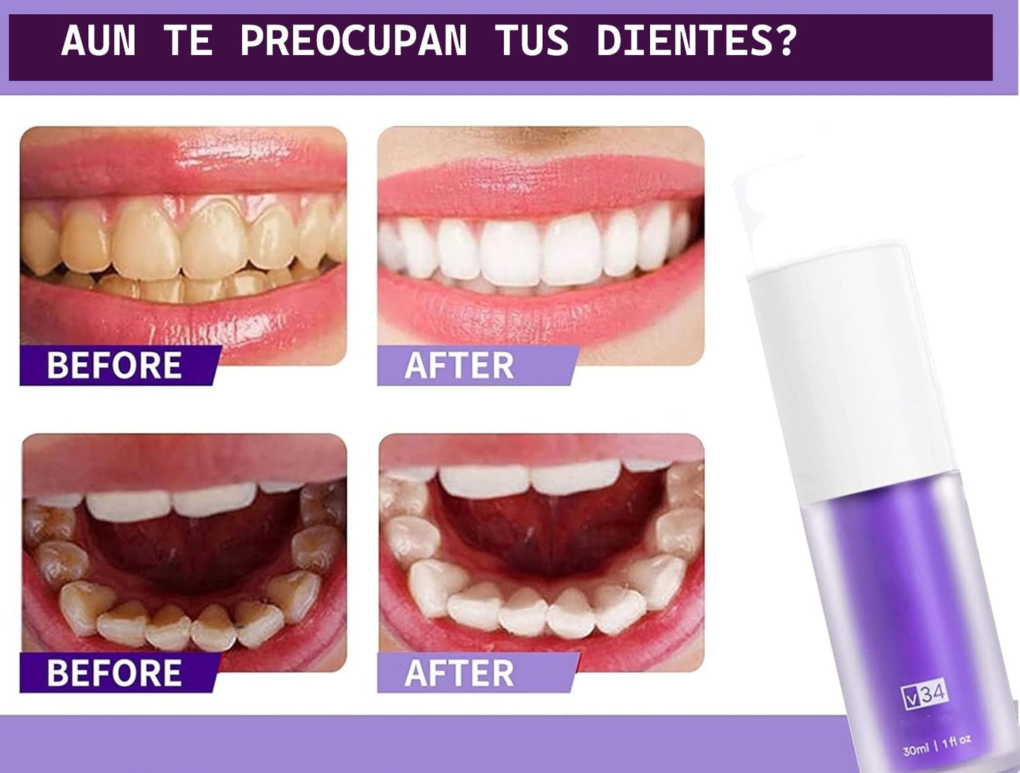 BlanColor v34  Blanquedor Dental en 5 Minutos, BriGlow