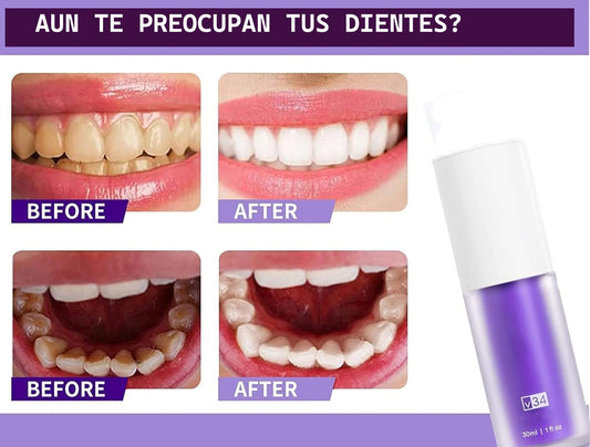 BlanColor v34  Blanquedor Dental en 5 Minutos, BriGlow