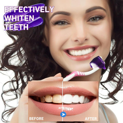 BlanColor v34  Blanquedor Dental en 5 Minutos, BriGlow